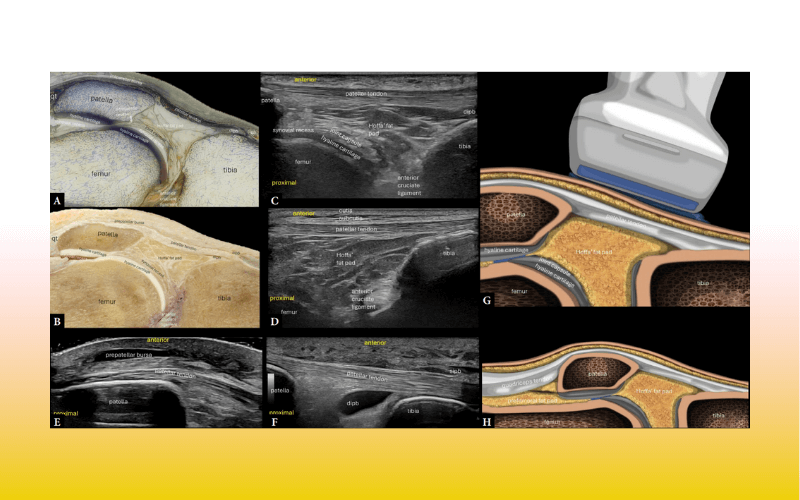 7. Compartimento anterior rodilla tempo formacion.png